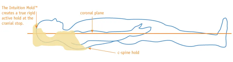 Intuition Click Mold graphic