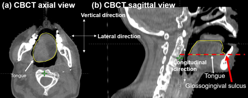 CBCT AXIAL + SAGITTAL VIEWS WITH THE O-TYPE POSITIONER